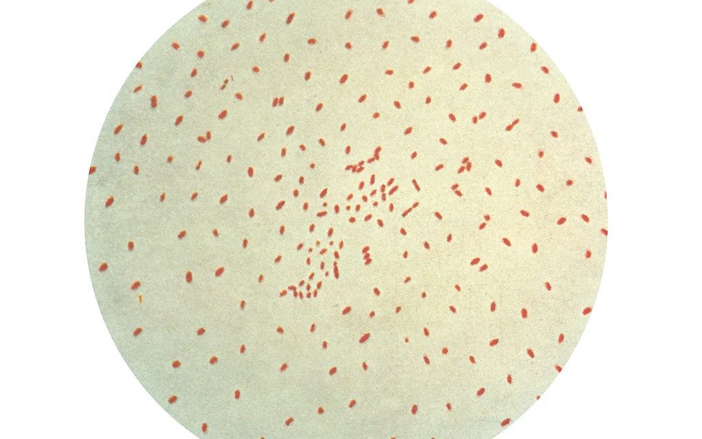 Pertussis – Keuchhusten
