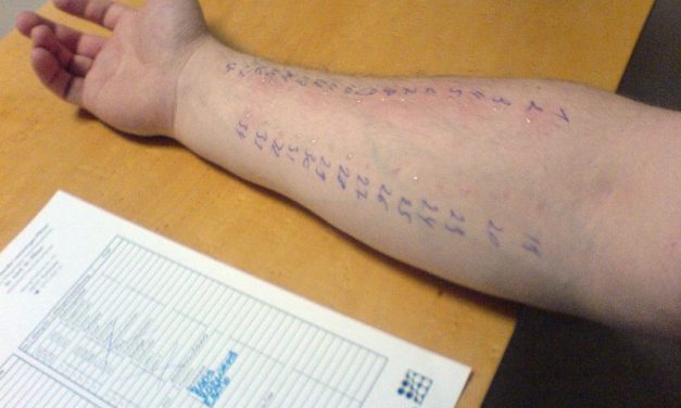 Allergietest